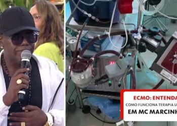 MC Marcinho usa terapia conhecida como ECMO, espécie de pulmão artificial; entenda como funciona